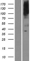 BIGM103 (SLC39A8) Human Over-expression Lysate