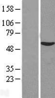 C14orf133 (VIPAS39) Human Over-expression Lysate