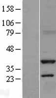 Serine racemase (SRR) Human Over-expression Lysate