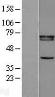 Retinoid X Receptor beta (RXRB) Human Over-expression Lysate