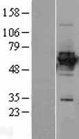 HLX1 (HLX) Human Over-expression Lysate