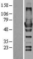 RIC8 (RIC8A) Human Over-expression Lysate