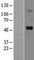 SLC5A7 Human Over-expression Lysate