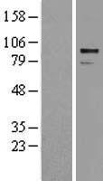 ADAM30 Human Over-expression Lysate