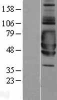 SIGIRR Human Over-expression Lysate