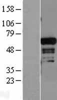 ADAM28 Human Over-expression Lysate