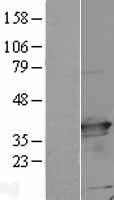 CFAP298 Human Over-expression Lysate