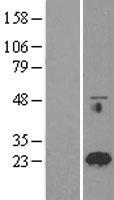 RAB18 Human Over-expression Lysate