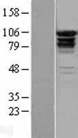 EPS15R (EPS15L1) Human Over-expression Lysate