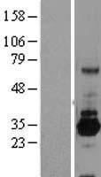 SRPR beta (SRPRB) Human Over-expression Lysate
