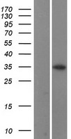 CCNB1IP1 Human Over-expression Lysate