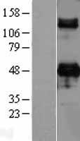 DC SIGN (CD209) Human Over-expression Lysate
