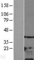 Thymosin beta 10 (TMSB10) Human Over-expression Lysate