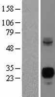 Neurogenin3 (NEUROG3) Human Over-expression Lysate