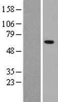 AMY2B Human Over-expression Lysate