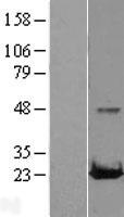 RAB22A Human Over-expression Lysate