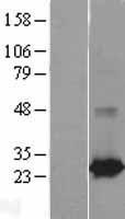 RAB25 Human Over-expression Lysate