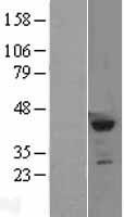 KMT5A Human Over-expression Lysate