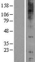 GPR84 Human Over-expression Lysate