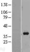 AKR1B10 Human Over-expression Lysate