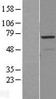 RAD18 Human Over-expression Lysate