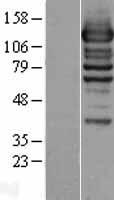 WDR44 Human Over-expression Lysate
