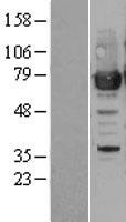 PRMT7 Human Over-expression Lysate