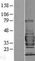 TOLLIP Human Over-expression Lysate