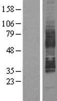 GPR85 Human Over-expression Lysate