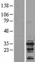 BIN3 Human Over-expression Lysate