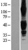 TROY (TNFRSF19) Human Over-expression Lysate