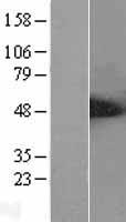 ALS2CR2 (STRADB) Human Over-expression Lysate