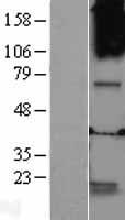 GABRQ Human Over-expression Lysate
