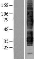 C5L2 (C5AR2) Human Over-expression Lysate