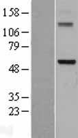 DDX28 Human Over-expression Lysate