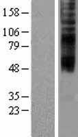 TMEM144 Human Over-expression Lysate