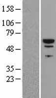 PI 4 Kinase type 2 beta (PI4K2B) Human Over-expression Lysate