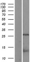 CDCA8 Human Over-expression Lysate