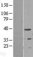 TIPIN Human Over-expression Lysate