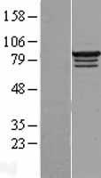 RBM28 Human Over-expression Lysate