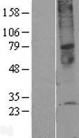 TMEM45A Human Over-expression Lysate