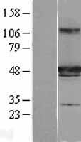 HIPPI (IFT57) Human Over-expression Lysate
