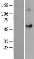 Acyltransferase like 1 (LPCAT2) Human Over-expression Lysate