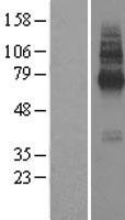 TMEM104 Human Over-expression Lysate