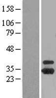 OTUB1 Human Over-expression Lysate