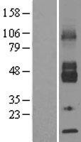SLC2A6 Human Over-expression Lysate