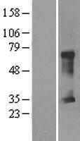 CLIC5 Human Over-expression Lysate