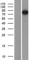 gamma Adducin (ADD3) Human Over-expression Lysate