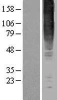 GPR83 Human Over-expression Lysate