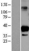 SIRT6 Human Over-expression Lysate